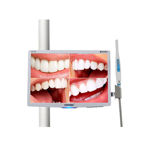 牙科内窥镜一体机,口腔观察仪,高清口腔内窥镜,摄像头,牙科设备